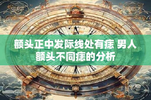 额头正中发际线处有痣 男人额头不同痣的分析