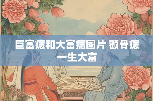 巨富痣和大富痣图片 颧骨痣一生大富