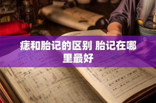 痣和胎记的区别 胎记在哪里最好