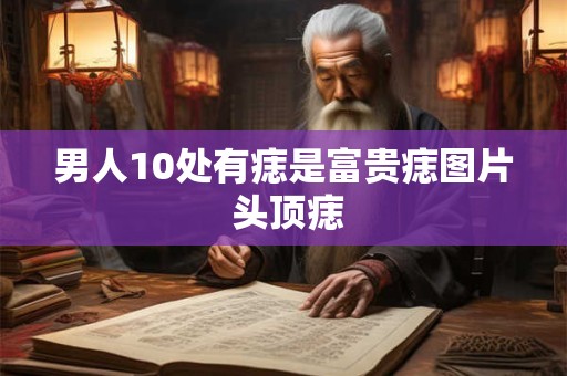 男人10处有痣是富贵痣图片 头顶痣