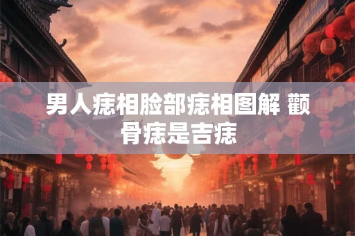 男人痣相脸部痣相图解 颧骨痣是吉痣