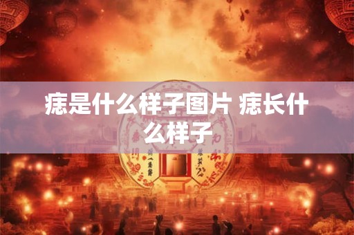 痣是什么样子图片 痣长什么样子