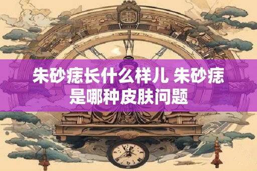 朱砂痣长什么样儿 朱砂痣是哪种皮肤问题