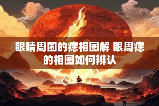 眼睛周围的痣相图解 眼周痣的相图如何辨认