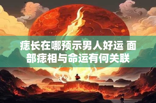 痣长在哪预示男人好运 面部痣相与命运有何关联