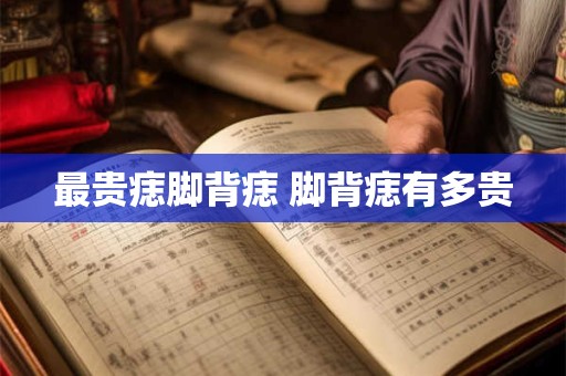 最贵痣脚背痣 脚背痣有多贵
