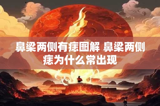 鼻梁两侧有痣图解 鼻梁两侧痣为什么常出现