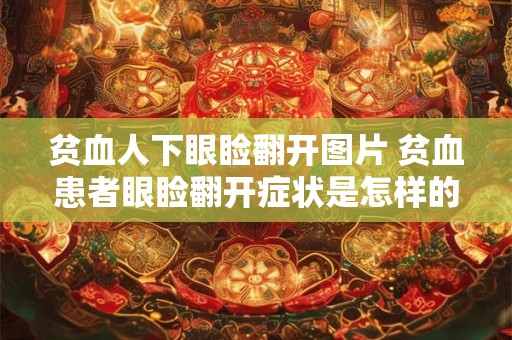 贫血人下眼睑翻开图片 贫血患者眼睑翻开症状是怎样的