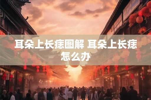耳朵上长痣图解 耳朵上长痣怎么办