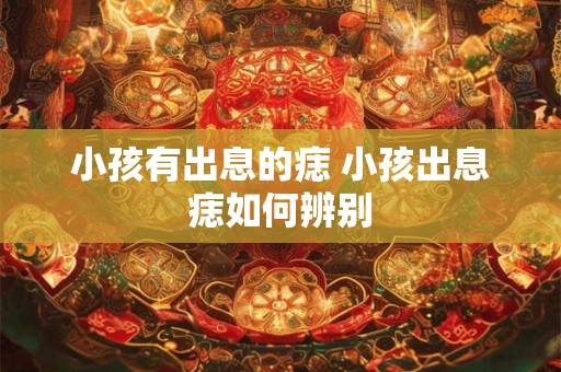 小孩有出息的痣 小孩出息痣如何辨别