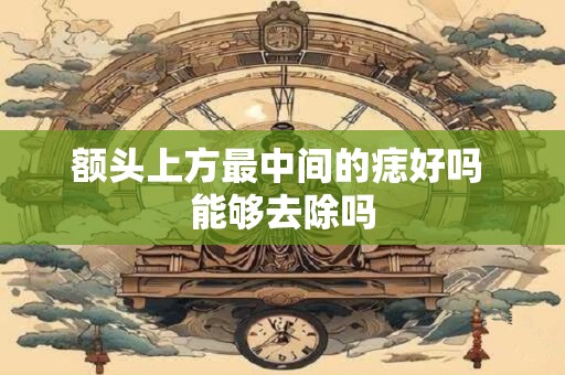 额头上方最中间的痣好吗 能够去除吗